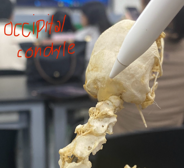 <p>Occipital condyle</p>