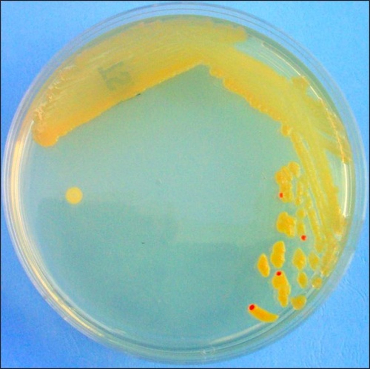 <p>Error in streaking:</p>