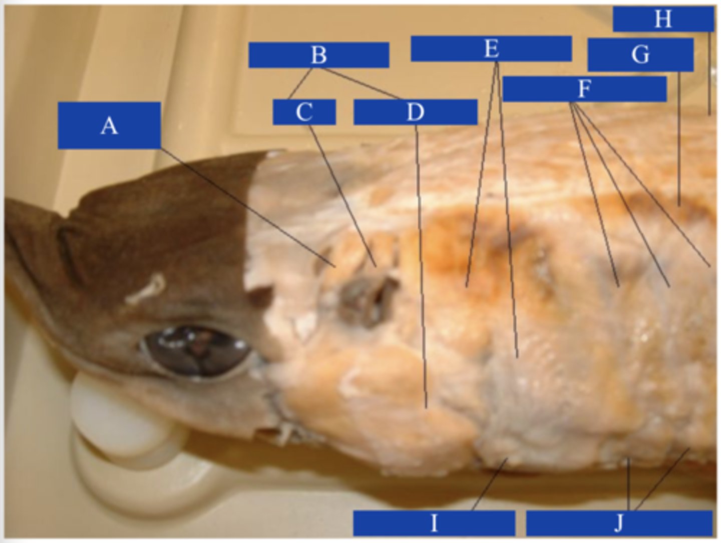 <p>What does letter A point to? (first levator)</p>