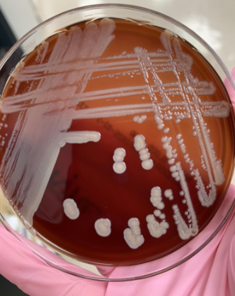 <p>lets say the gram stain showed GPB that were stacking, what organism would this be</p>