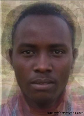 <p>Identify this Phenotype</p>