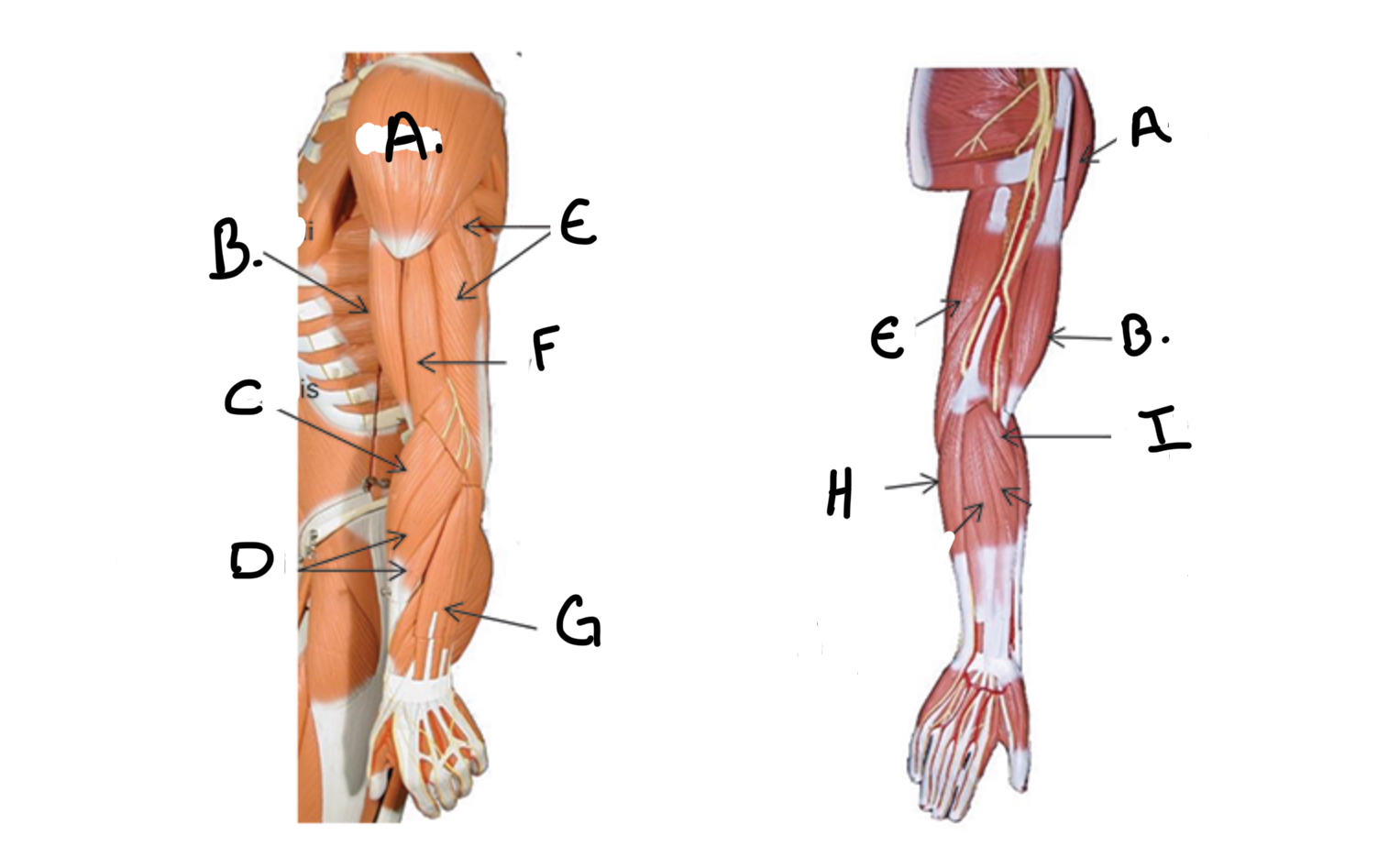 <p>Type of muscle: Upper Extremity</p><p>What is G?</p>