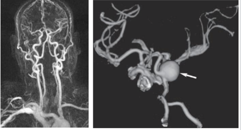 <p>What is this and what type of scan </p>