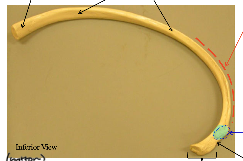 <p>Name the highlighted structure</p>