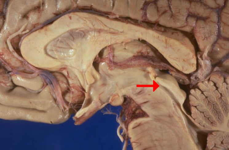 <p>Label this brain part</p>