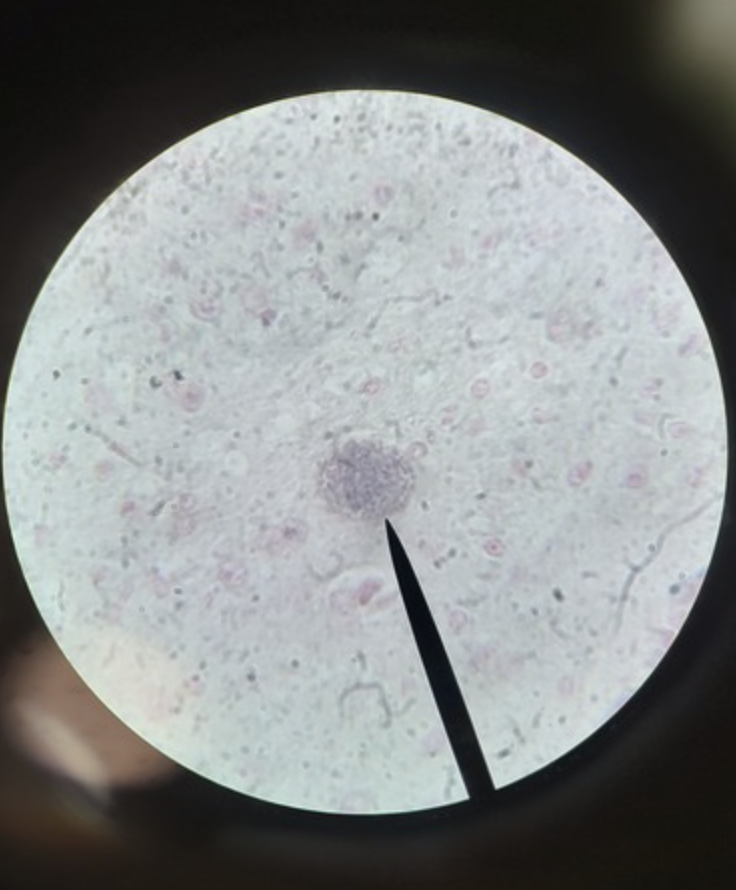 <ul><li><p>identify</p></li><li><p>m.o.t</p></li><li><p>infective stage</p></li><li><p>d host, i host</p></li></ul><p></p>