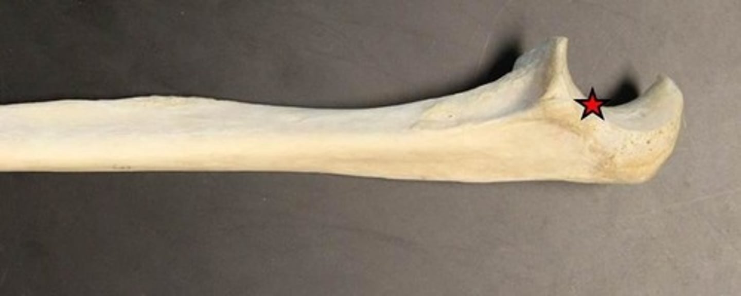 <p>ID large curve indicated by star</p>