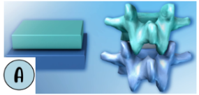 <p>As the body moves, the vertebrae of the spine move against each other as gliding joints (Intervertebral, Carpal, and Tarsal). </p>