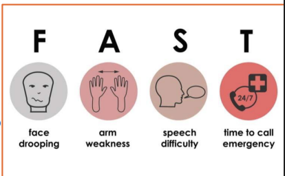 <p>● Brain damage caused by vascular disruptions such blockage of blood supply or bleeding. </p><p>Common Abrupt Symptoms: <span data-name="black_small_square" data-type="emoji">▪</span>weakness or numbness on one side of the body. <span data-name="black_small_square" data-type="emoji">▪</span>impairment of vision, especially in one eye. </p><p><span data-name="black_small_square" data-type="emoji">▪</span>difficulty speaking or understanding speech. </p><p><span data-name="black_small_square" data-type="emoji">▪</span>episodes of dizziness or falls. <span data-name="black_small_square" data-type="emoji">▪</span>severe headache, especially with any other symptoms </p><p>2 Types: </p><p>1. Ischemic (deprived of blood) </p><p>2. Hemorrhagic (caused by rupture of artery)</p>