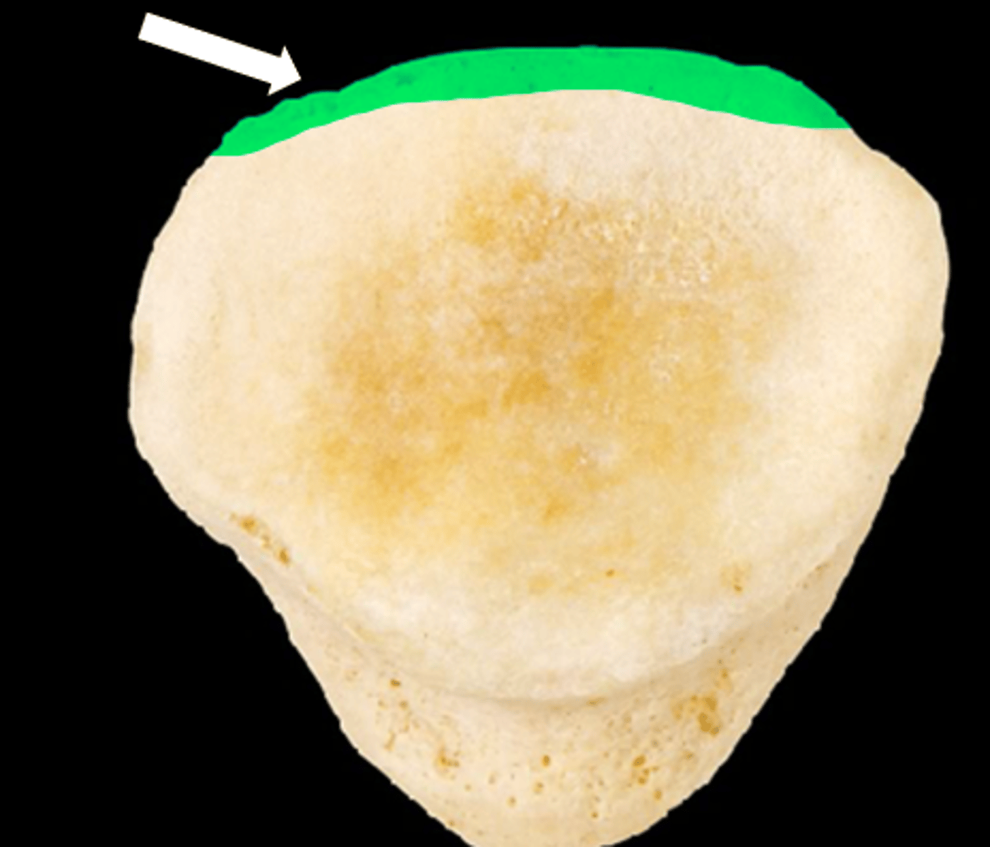 <p>name the part</p>