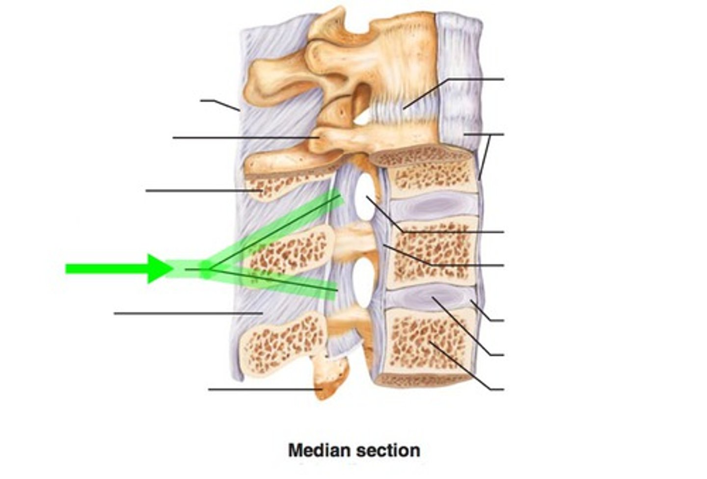 <p>- ligament running from the lamina of one vertebrae to the lamina of an adjacent vertebrae</p>