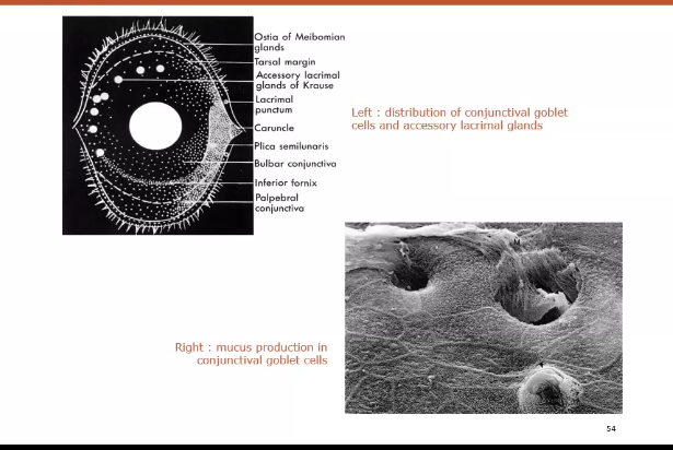 <p>poor mucin layer is shown on the right ,</p><p>dark areas are dry spots&nbsp;</p>