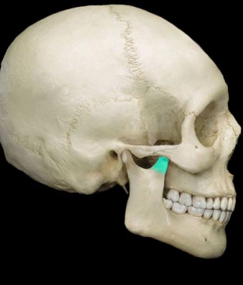 <p>Mandible: Coronoid process</p>