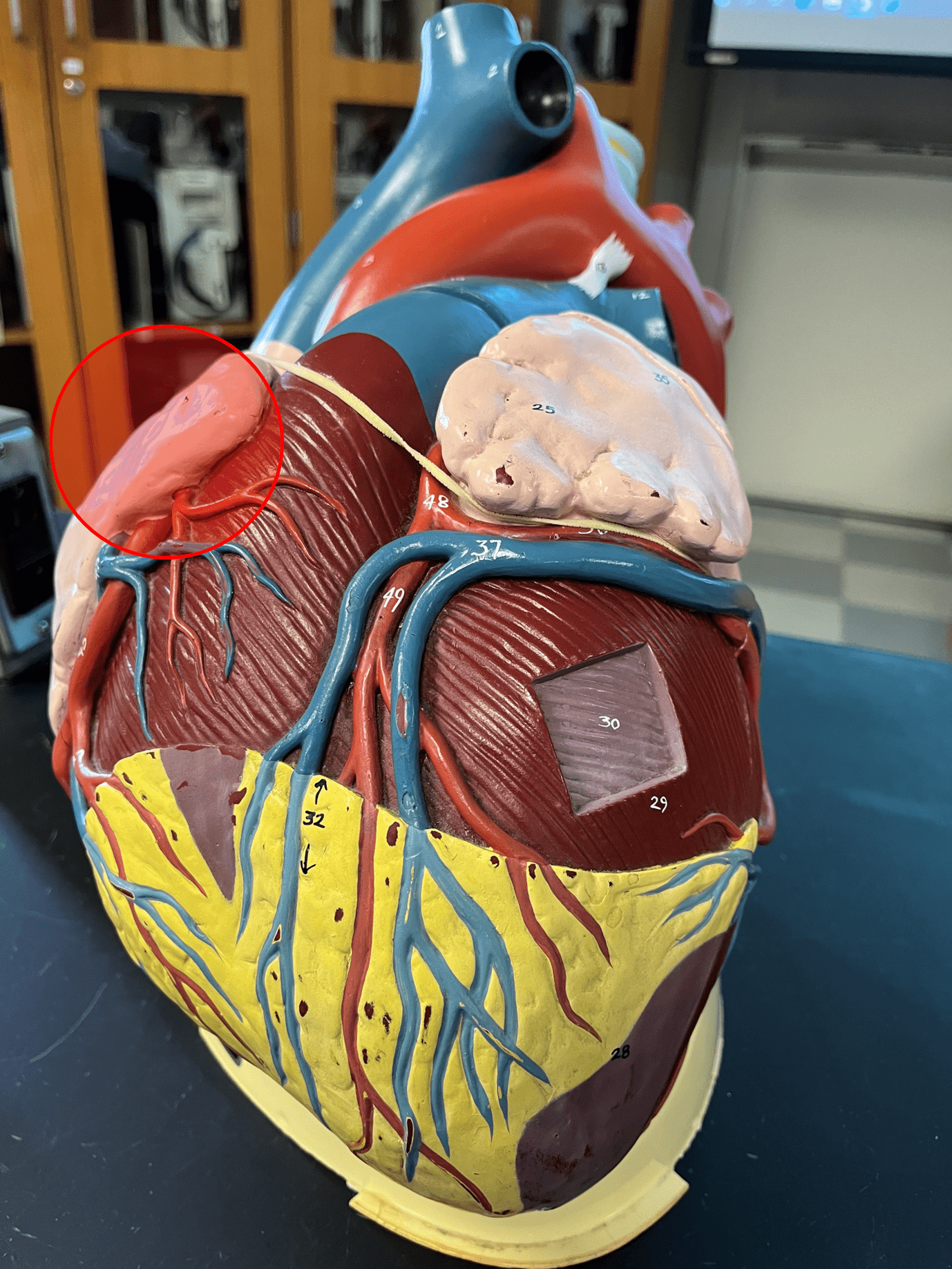 A sac contained within and increasing the volume of the right atrium.