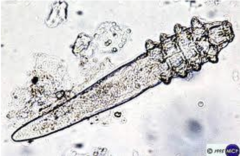 <p>What does Demodex refer to?</p>