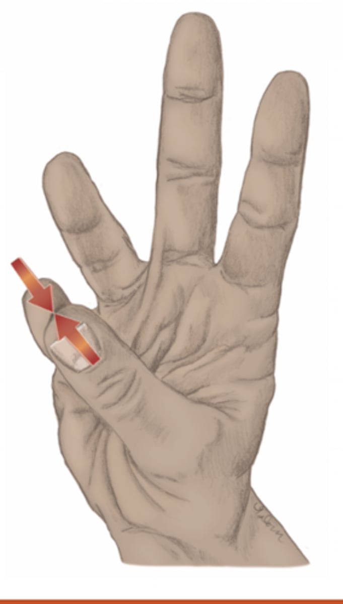 <p>please identify the movement and its location</p>