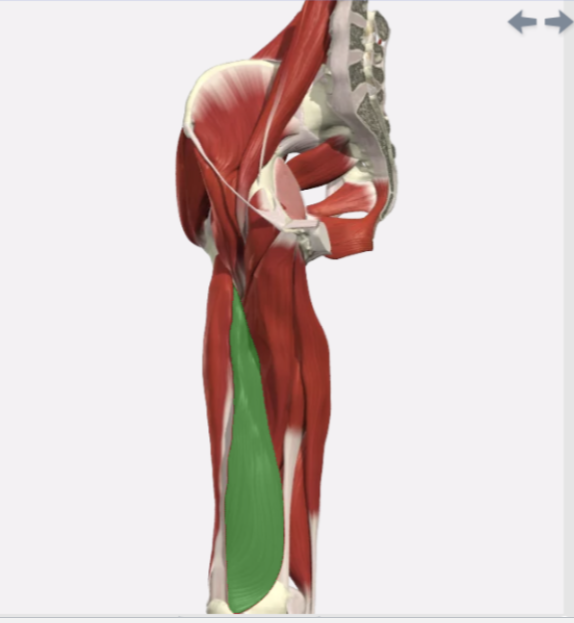 <p>Vastus Medialis </p>