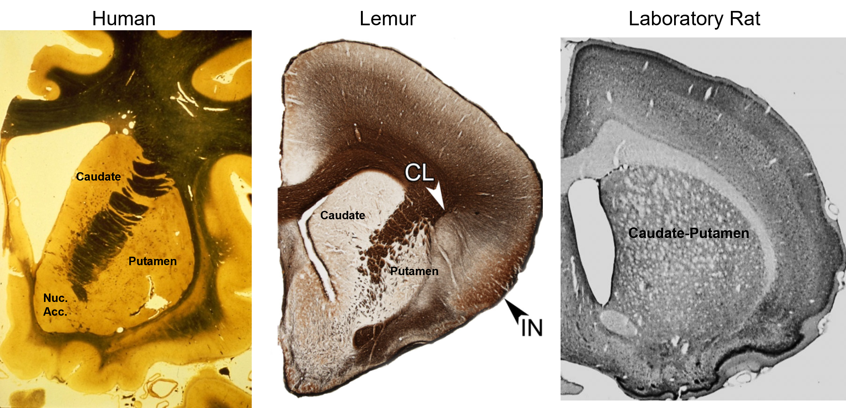 <p>the caudate and putamen are cytologically identical and have similar embryological origins</p>