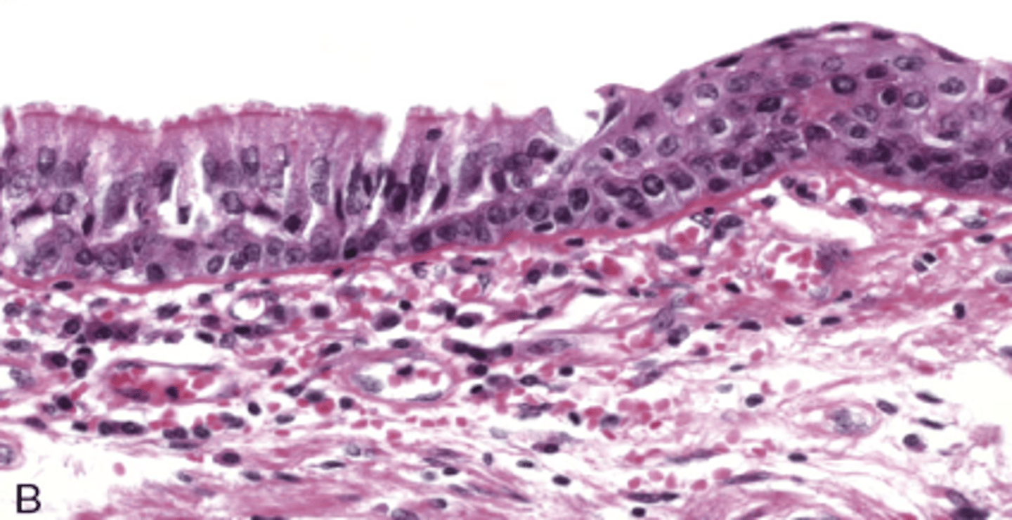 <p>What type of cellular adaptation is shown in this photo?</p>