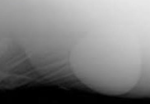 <p>rectal: gas distention, may palpate enterolith</p><p>radiographs</p>