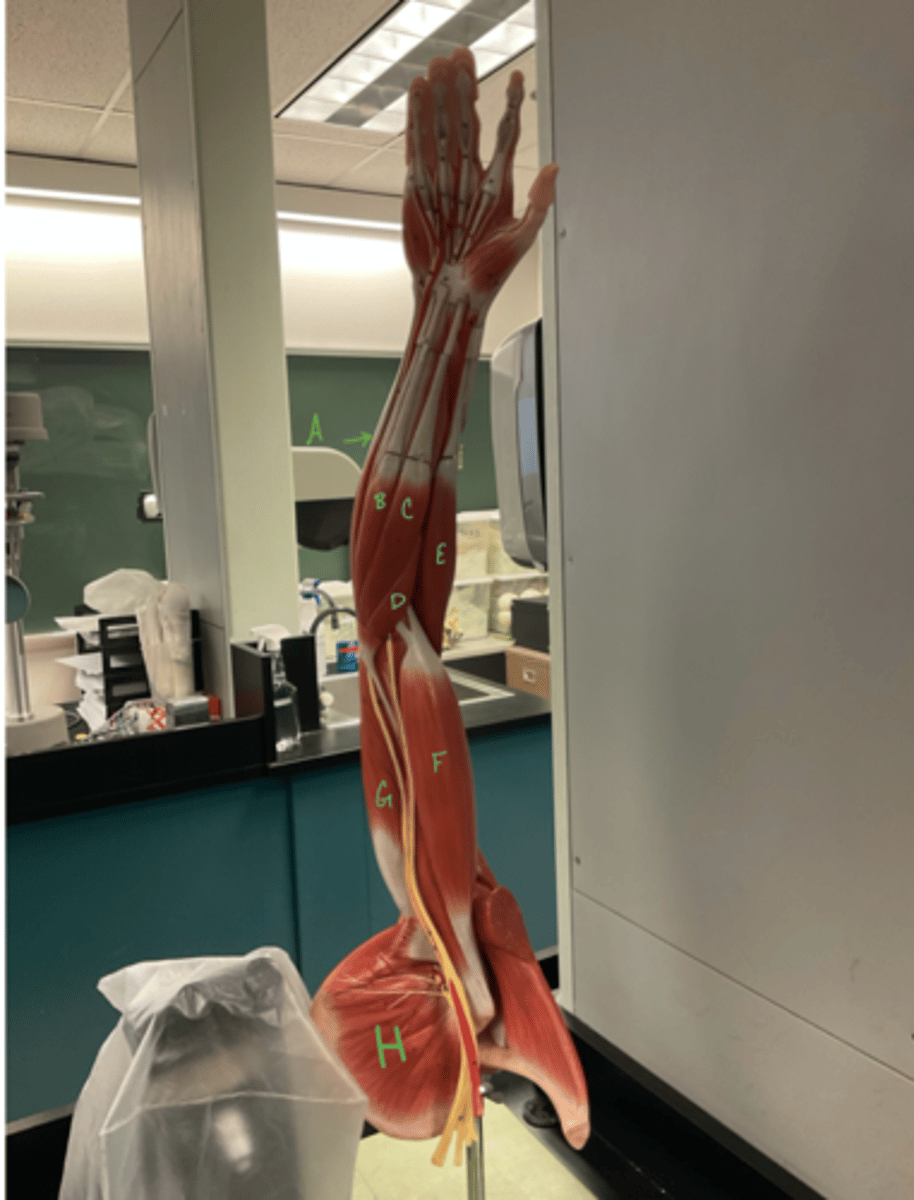 <p>flexor carpi radialis</p>