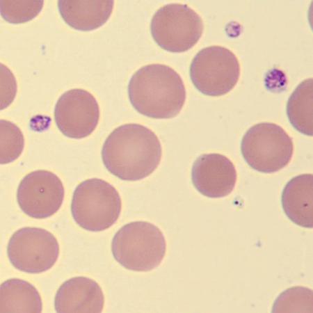 <p>What do these erythrocytes show?</p>