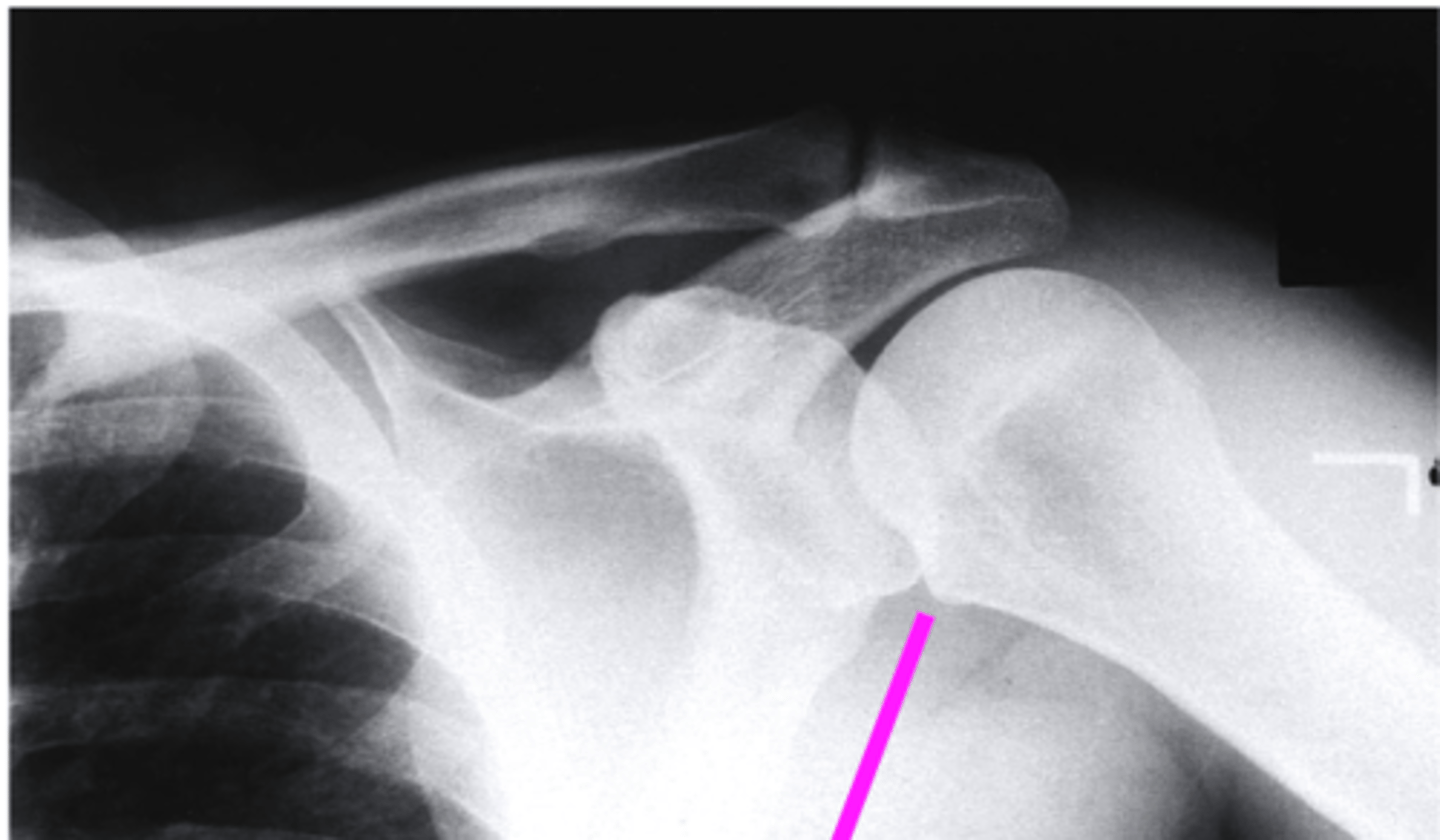 <p>what does the pink line point to?</p>