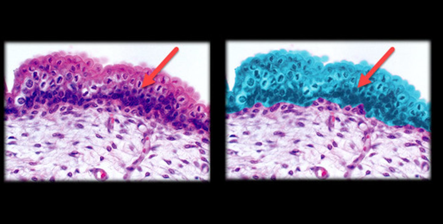 <p>- Cells change shape depending on whether the tissue is stretched or relaxed.</p><p>- In the relaxed state, the cells appear large and dome-shaped. When stretched, the cells flatten and resemble stratified squamous epithelium.</p><p>- Found in the bladder and urinary tract, specialized for stretching.</p>