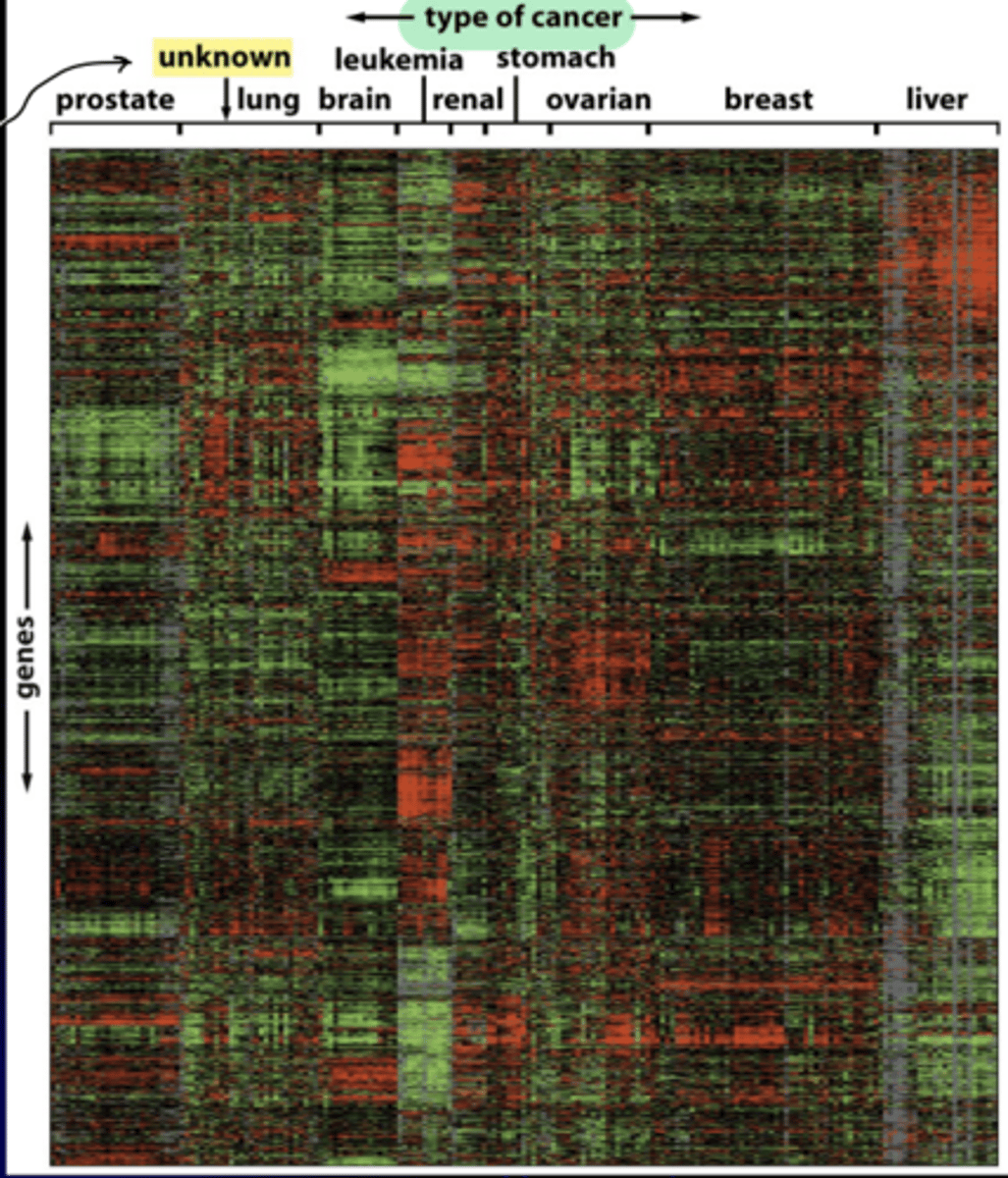 <p>allows evaluation of thousands of gene expression patterns in a given cell type</p><p>- small red bars = high gene exp</p><p>- small green bars = low gene exp</p><p>- vertical axis= exp levels of 1800 genes in this array</p><p>- horizontal axis = mRNAs from 142 different human tumors</p>