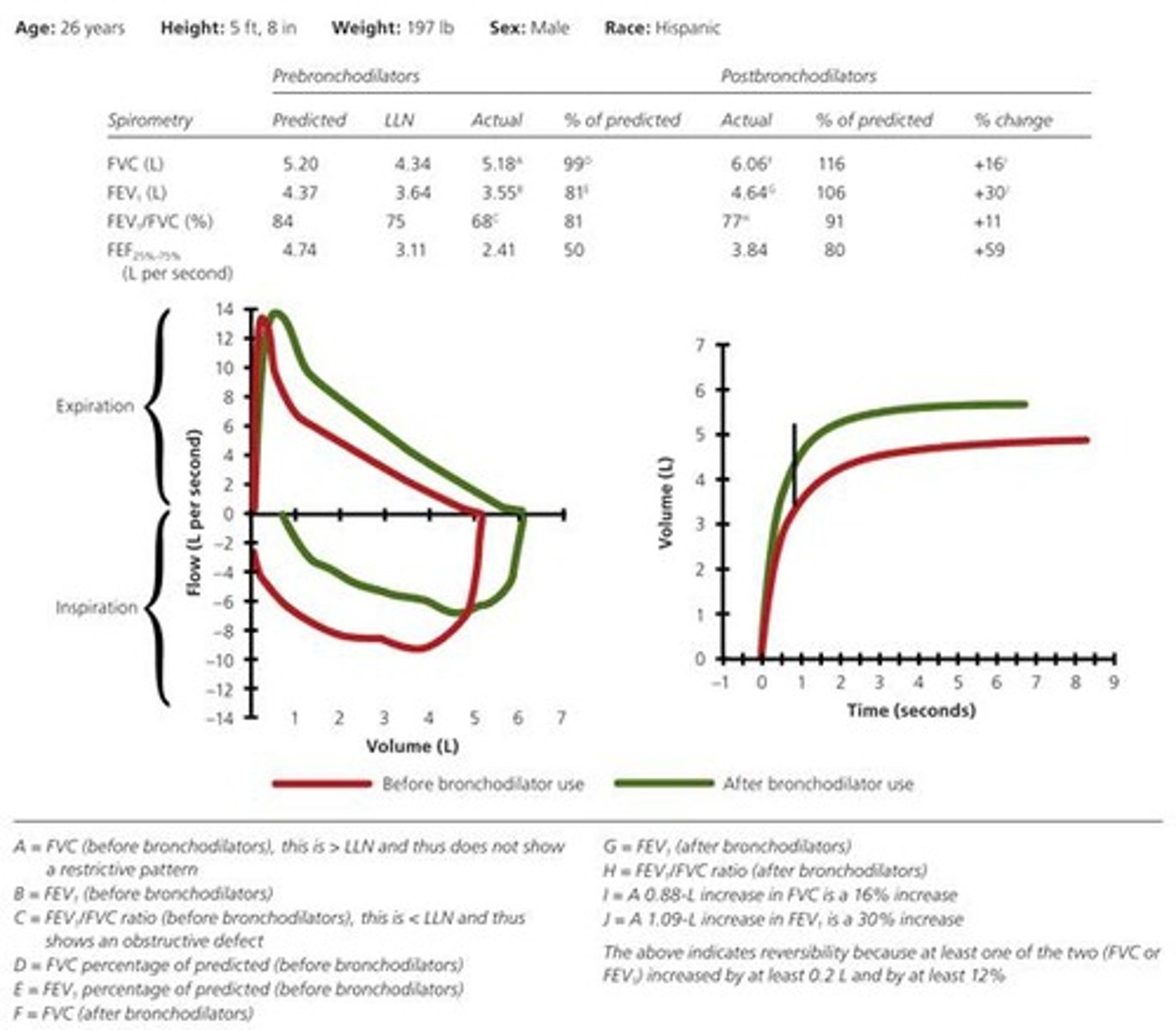 <p>A significant improvement in airflow after bronchodilator treatment.</p>