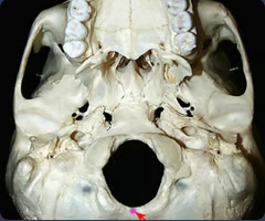 <p>Midline point at the posterior margin of the foramen magnum</p>