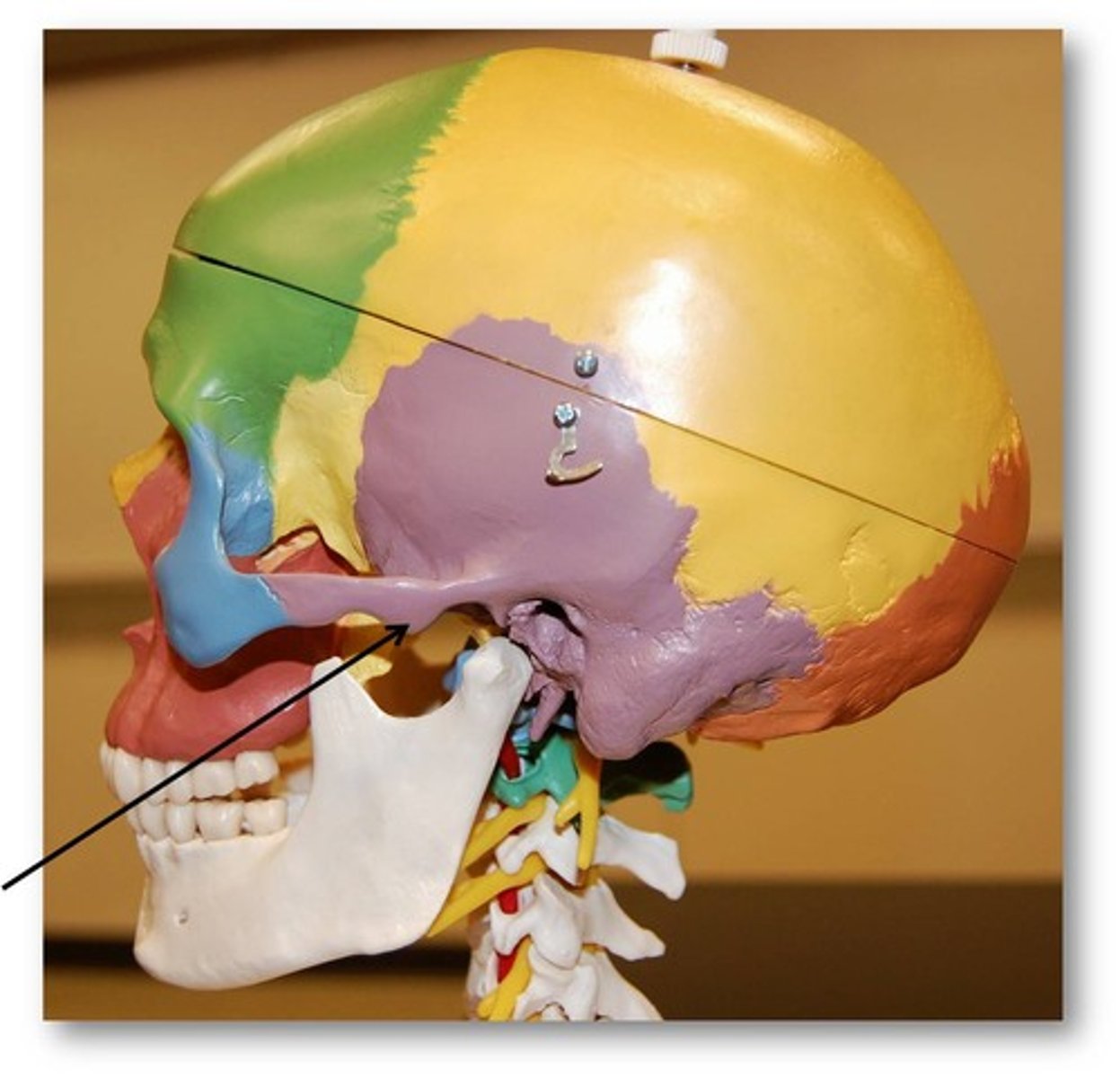 <p>front boundary of mandibular fossa</p>