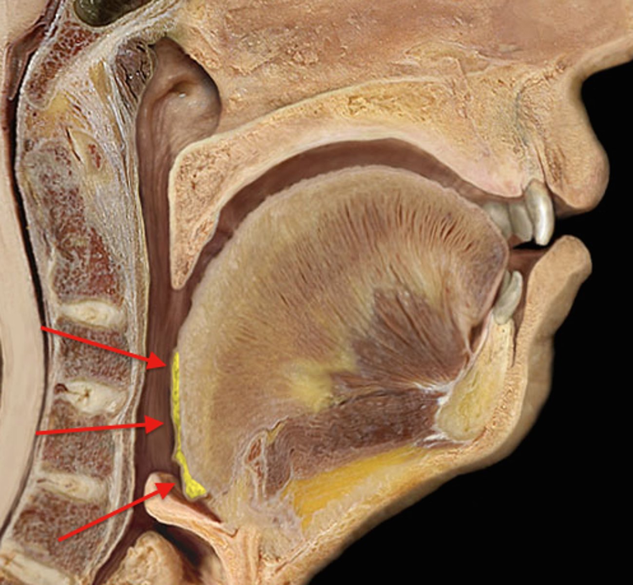 <p>Location: Base of the tongue</p><p>Description: N/A</p>