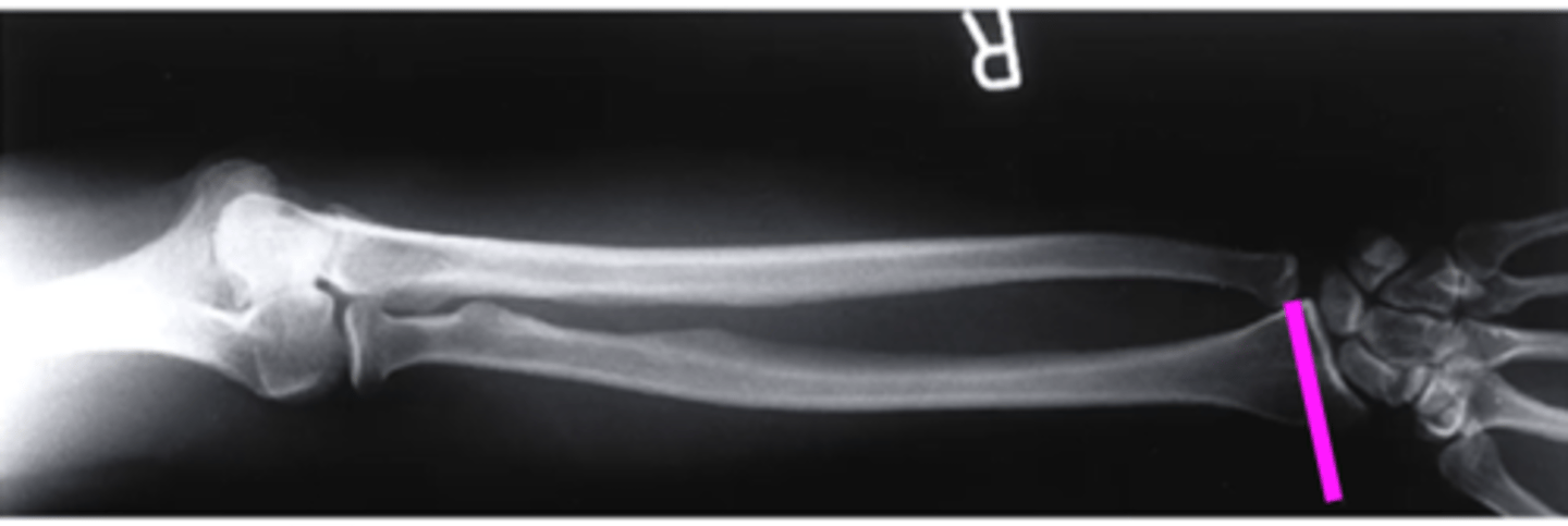 <p>what does this pink line point to?</p>