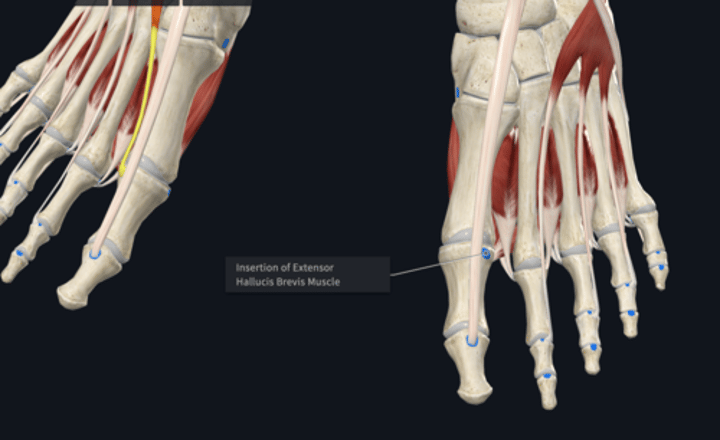 <p>Insertion: extensor hallucis brevis</p>