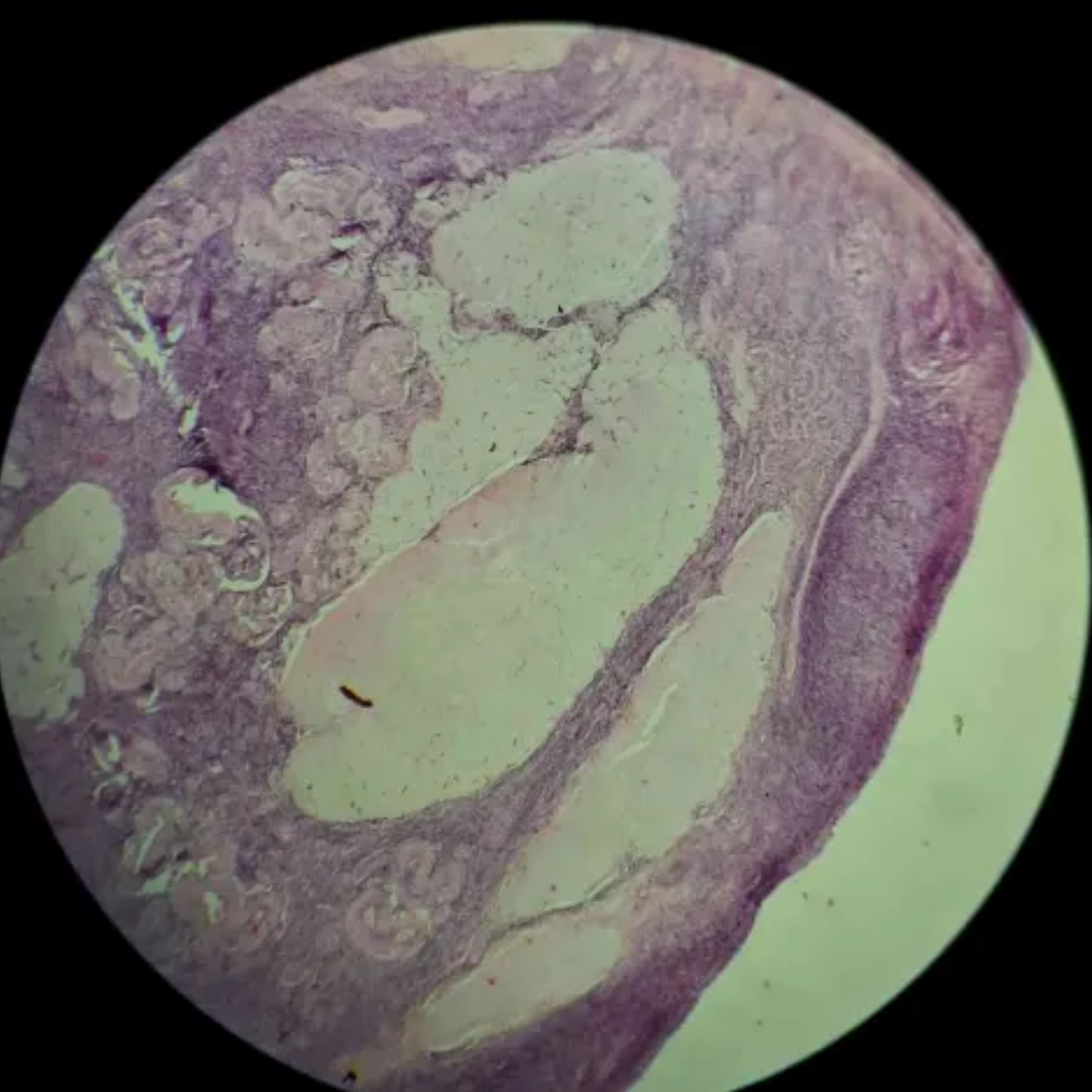 term image