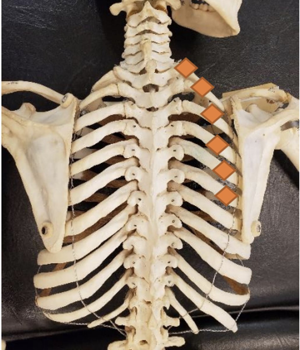 <p>posterosuperior portion of rub 1, lateral to costotransverse joint</p>