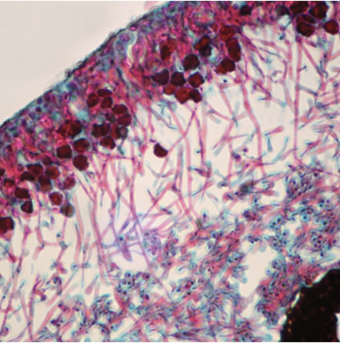 <p>What is this? What are the filaments? What is the dark balls/lining?</p>