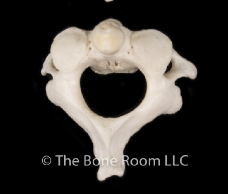 <p>Identify the part of the vertebra and explain what diagnostic features helped you reach your conclusion.</p>