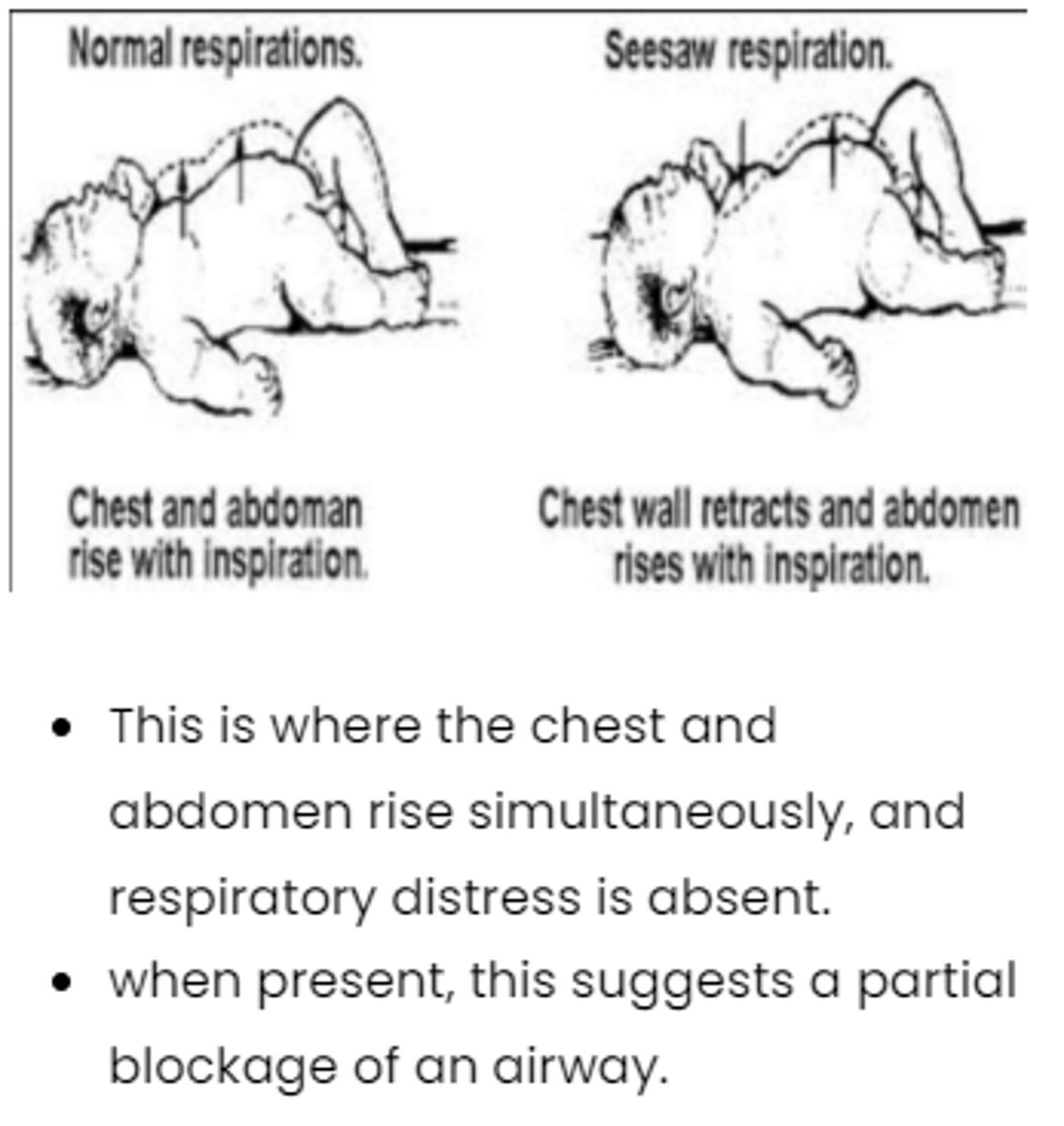 <p>chest and abdomen work in opposite directions</p>