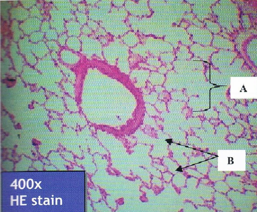 <p>Identify the structure and LE</p>