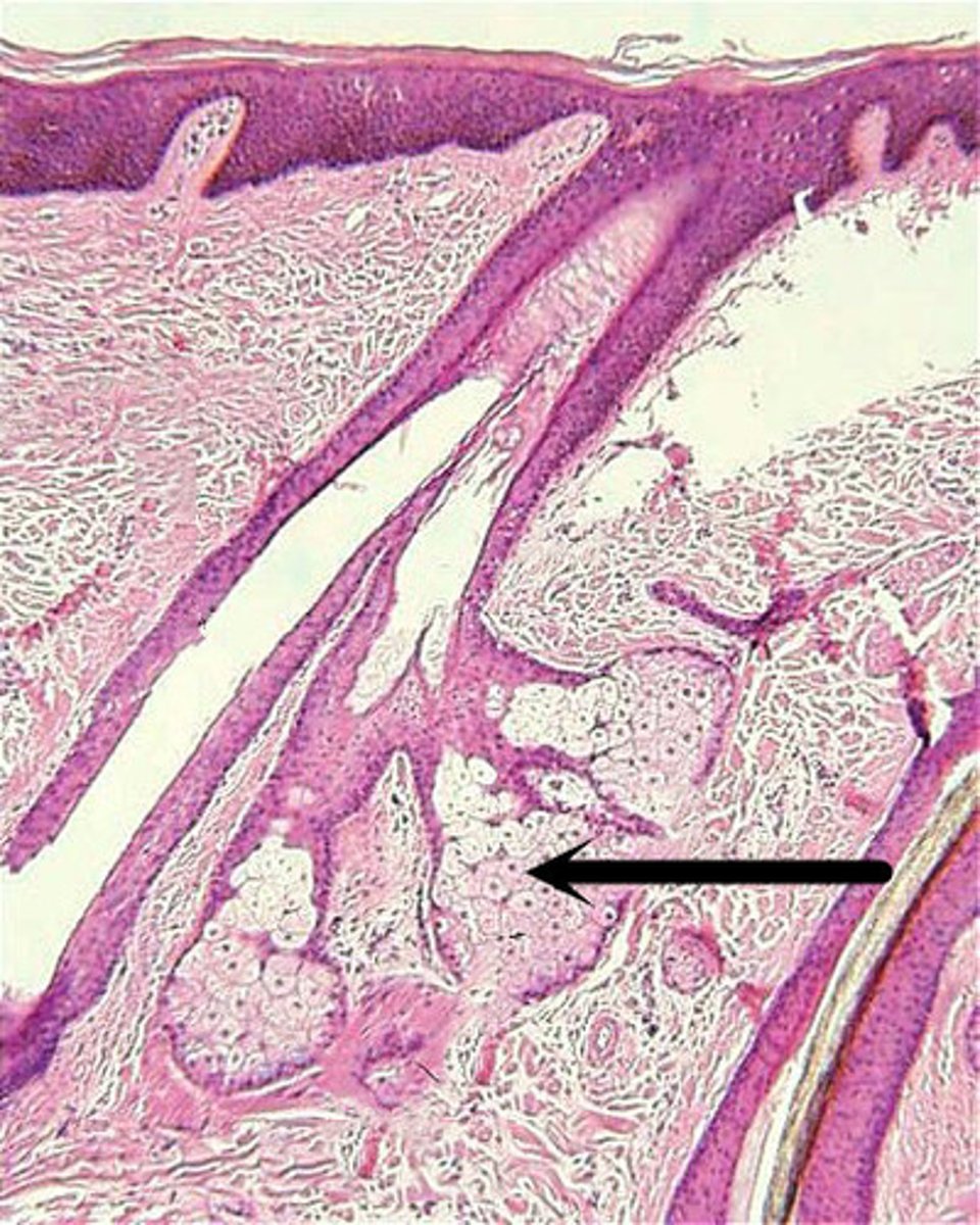 <p>oil-secreting gland in the dermis that is associated with hair follicles</p>