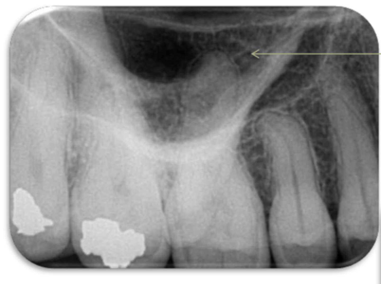 <p>ID the structure:</p>