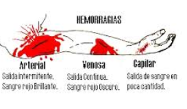 <p>Tras el accidente, el paciente sufrió una hemorragia severa que requirió transfusión de sangre.</p>
