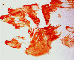 <p>Transfer Blood Spatter</p>