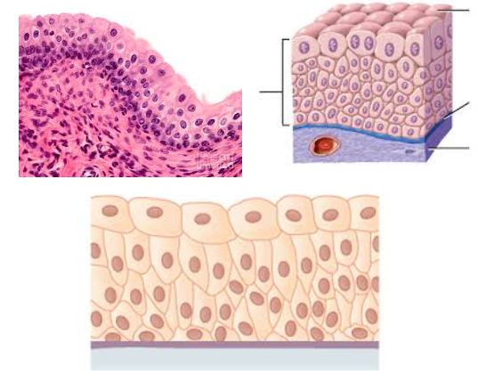 <p><strong>Transitional epithelium</strong></p>
