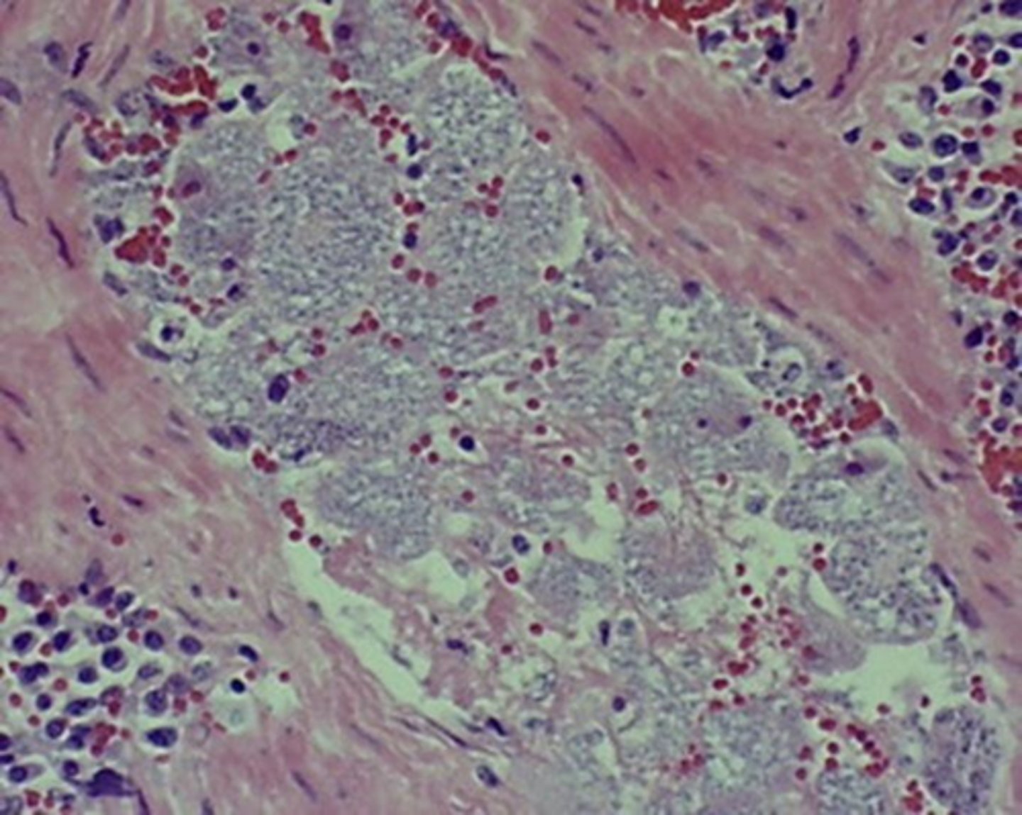 <p>Identify the tiny parasites occluding the blood vessel in the spleen of an icteric cat that died acutely?</p>