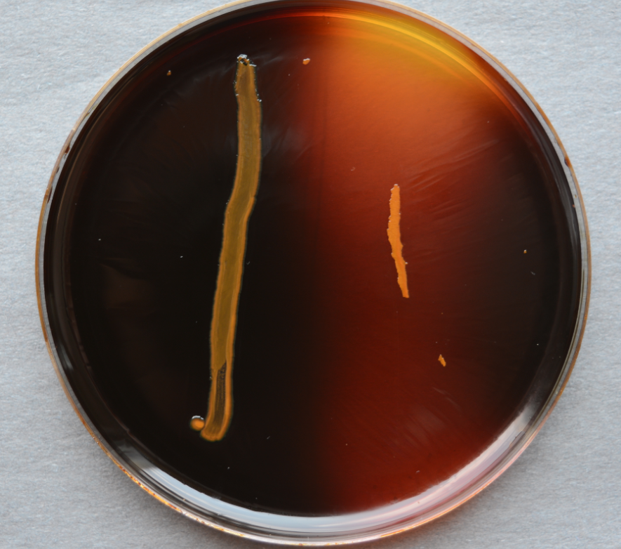 <p>Name this test</p><p>Which side is positive</p><p>Name the bacteria</p><p>Name the indicator</p>
