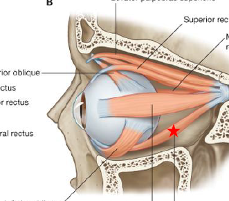 <p>ID/Describe this muscle</p>