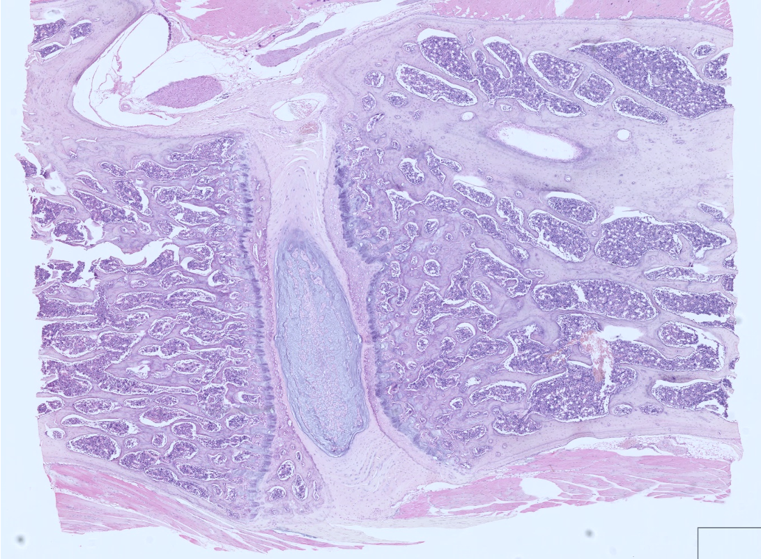 <p>Which cartilage is shown in the following image?</p>